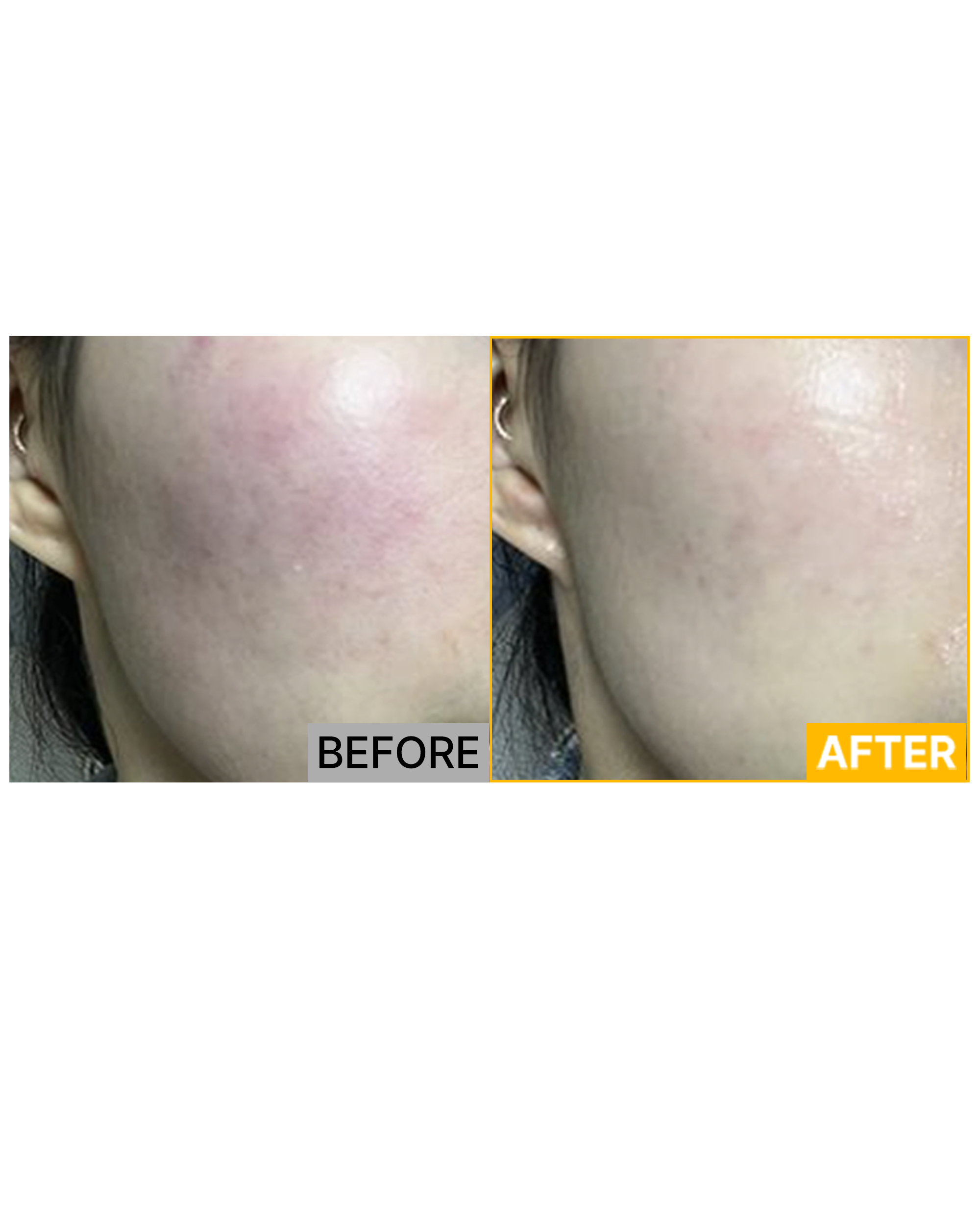 A.CNEX CREAM_Before & After