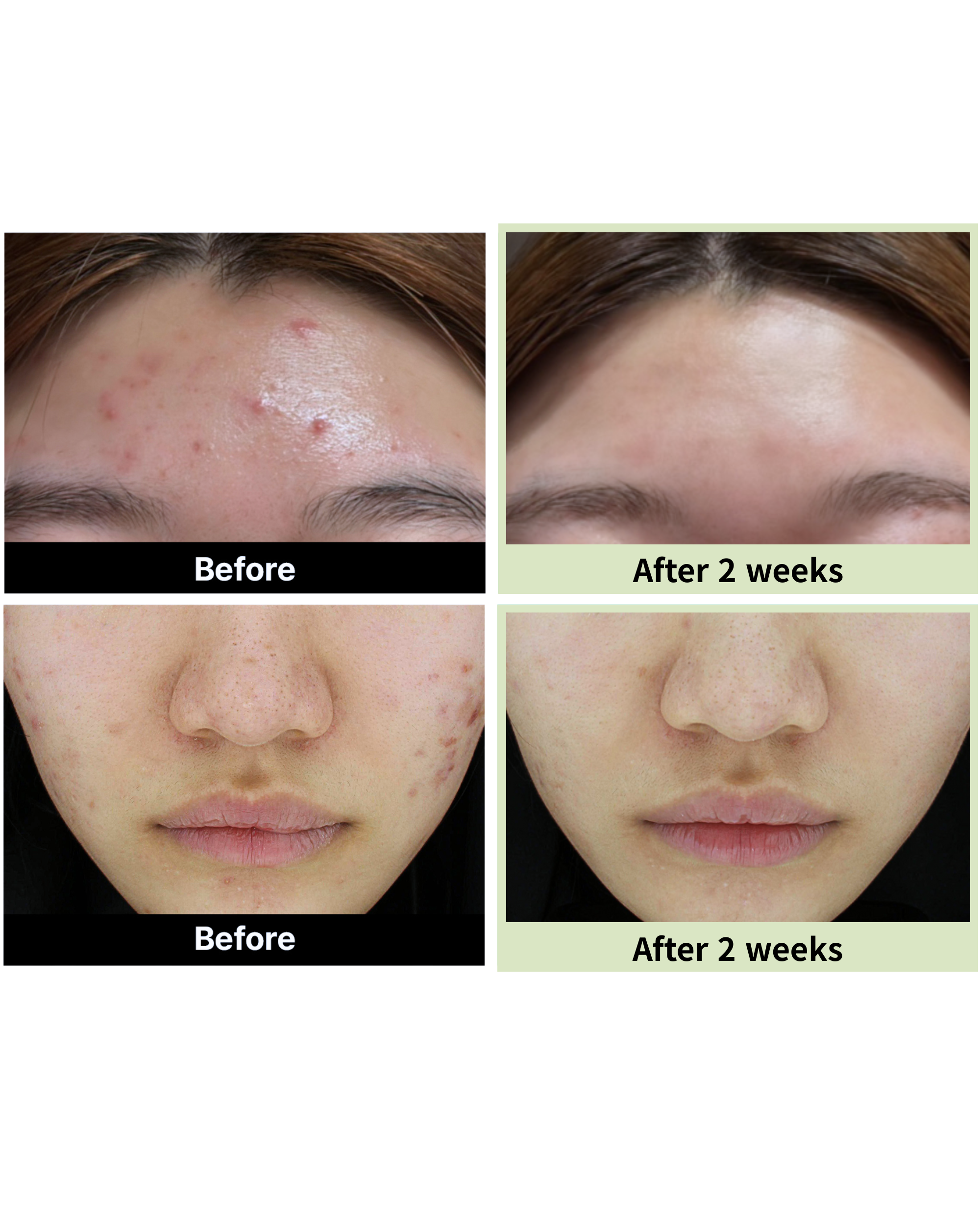 Control_Pad_Before_After