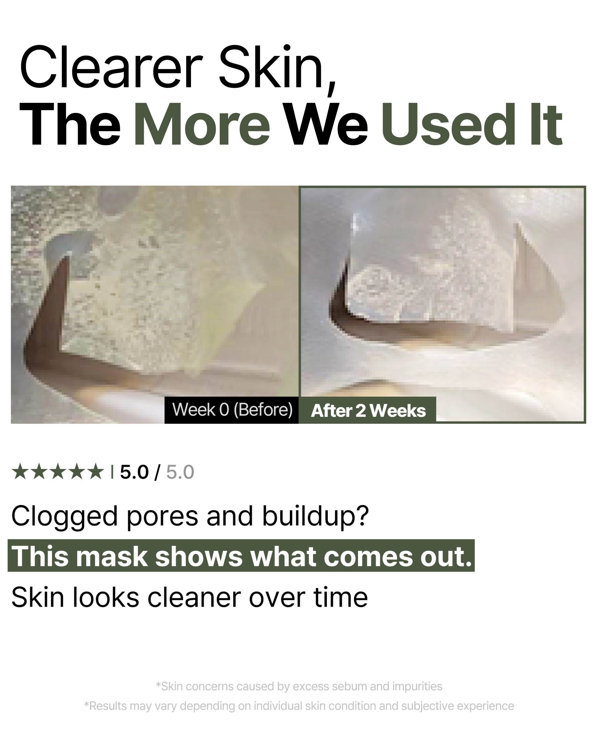 Trouble Patch Mask_Clearer Skin, the more we used it