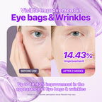 Botide Plumping Hydrogel Eye Patch