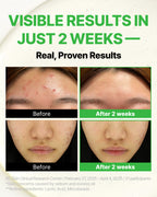 Trouble Control Pad_visible results in 2 weeks_Thumbnail