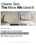 Trouble Patch Mask_Clearer Skin, the more we used it