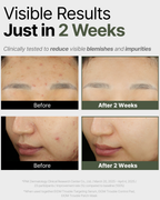 Trouble Patch Mask_Visible Results