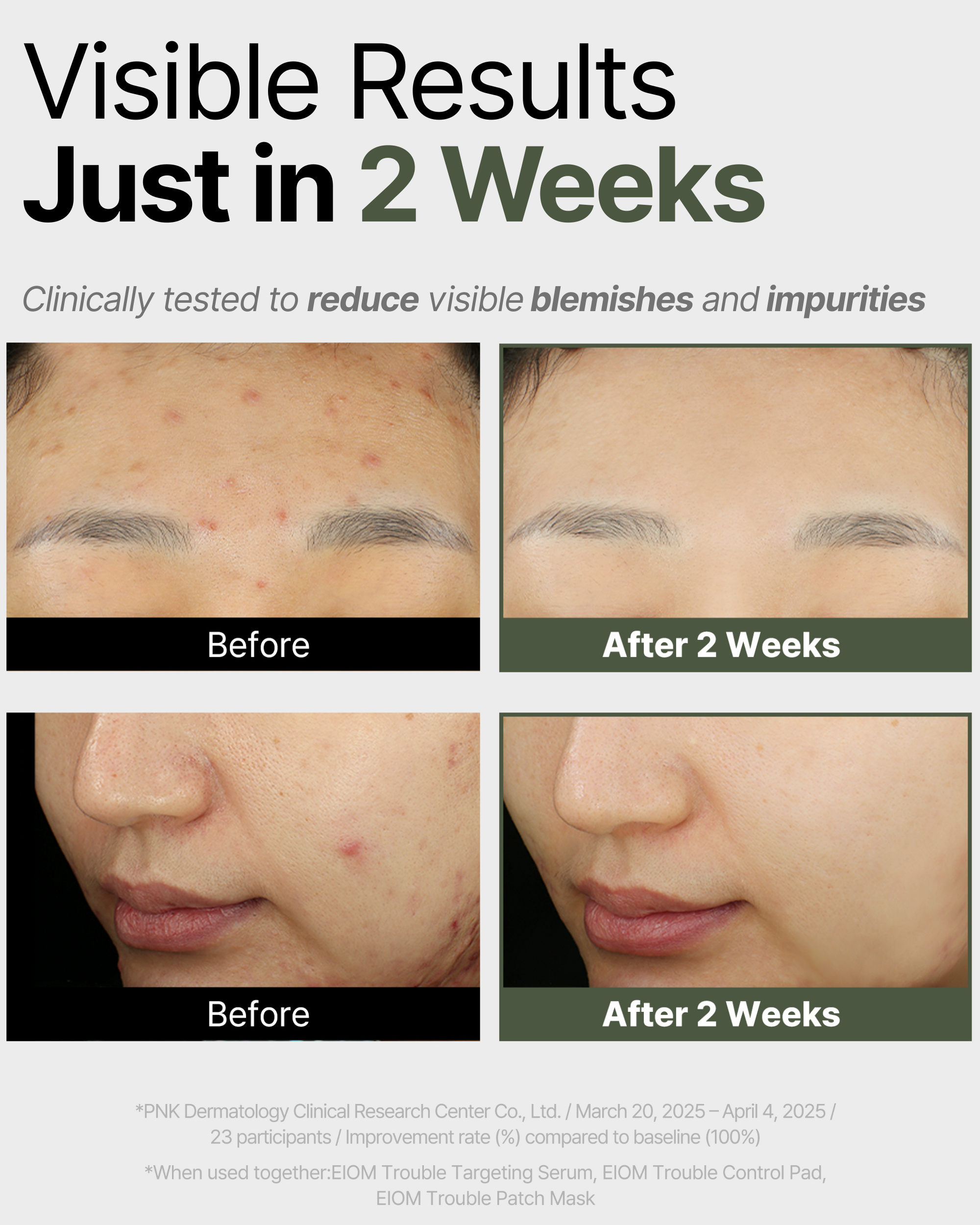 Trouble Patch Mask_Visible Results