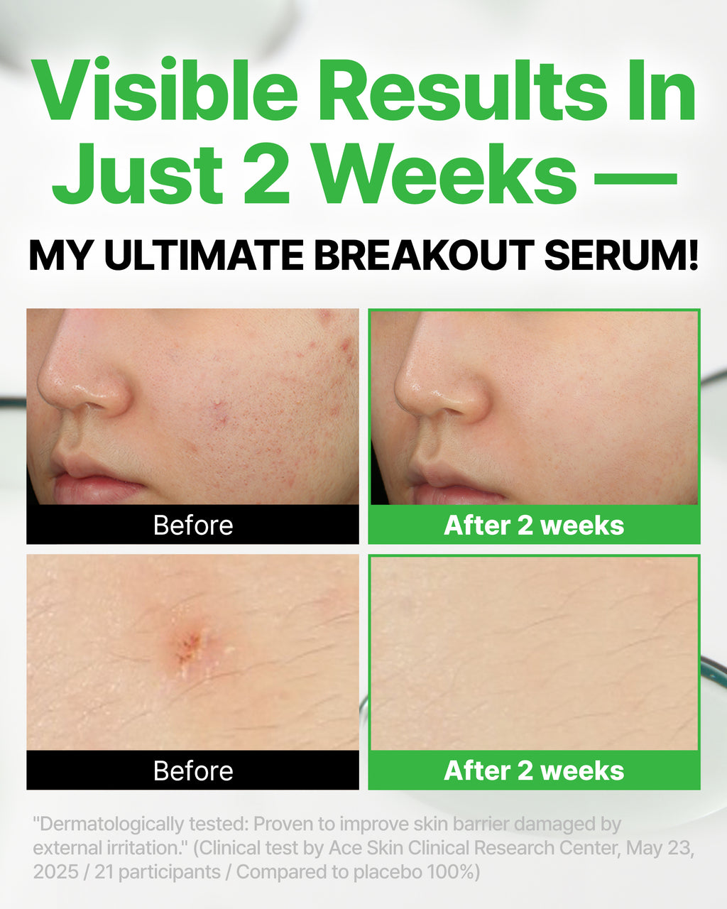 Trouble_Targeting_Serum_Thumnnail_5